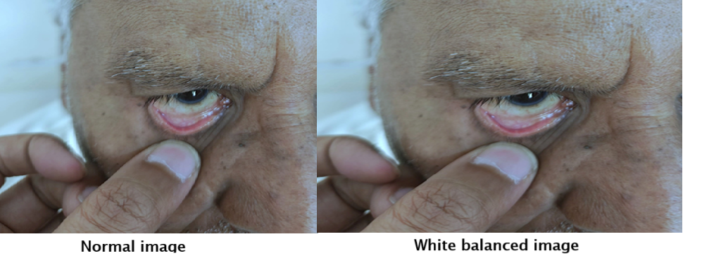 White Balancing Example